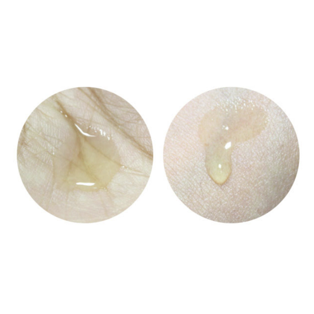 Ciracle Anti Blemish Spot A Sol 30ml