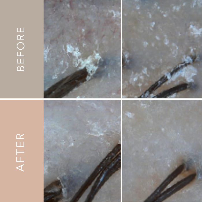 107 SCALP PURIFYING Microbiome Shampoo - Slowrecipe