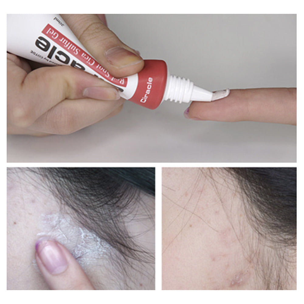 Ciracle Red Spot Cica Sulfur Gel 20ml